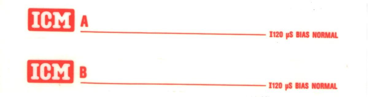 Compact Cassette ICM Ferro DX 90 Type I Normal 1986 Europe